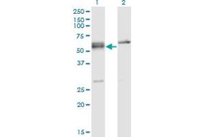 Western Blot analysis of SFRS6 expression in transfected 293T cell line by SFRS6 monoclonal antibody (M02), clone 5G6. (SFRS6 anticorps  (AA 1-75))