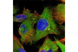 Immunofluorescent staining of human cell line U-251 MG shows positivity in plasma membrane, cytoplasm & golgi apparatus. (ZC3HAV1 anticorps)