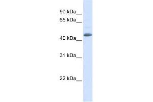 SNX5 antibody used at 1 ug/ml to detect target protein. (SNX5 anticorps  (N-Term))