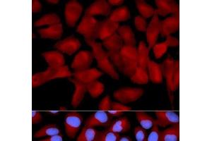 Immunofluorescence analysis of U2OS cells using EIF5A Polyclonal Antibody (EIF5A anticorps)