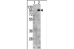 Western blot analysis of PIP5K1C (arrow) using PIP5K1G Antibody (C-term) (ABIN392596 and ABIN2842125). (PIP5K1C anticorps  (C-Term))