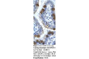 Immunohistochemistry (IHC) image for anti-Cyclin-Dependent Kinase 7 (CDK7) (C-Term) antibody (ABIN2792153)