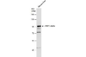 WB Image HNF1 alpha antibody [N1N3] detects HNF1 alpha protein by western blot analysis. (HNF1A anticorps)