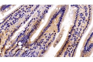 Detection of C1QBP in Mouse Colon Tissue using Polyclonal Antibody to Complement component 1 Q subcomponent-binding protein, mitochondrial (C1QBP)