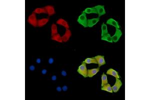 ABIN7095844 and ABIN7099906 staining Hela cells by IF/ICC. (B4GALNT3 anticorps)