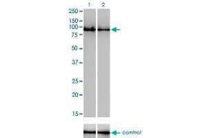 Western blot analysis of GOLGA5 over-expressed 293 cell line, cotransfected with GOLGA5 Validated Chimera RNAi (Lane 2) or non-transfected control (Lane 1). (GOLGA5 anticorps  (AA 2-99))