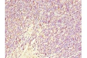 Immunohistochemistry of paraffin-embedded human thymus tissue using ABIN7153505 at dilution of 1:100 (GABRR1 anticorps  (AA 365-465))