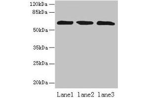 Western blot All lanes: ZNF554 antibody at 5 μg/mL Lane 1: K562 whole cell lysate Lane 2: U937 whole cell lysate Lane 3: A549 whole cell lysate Secondary Goat polyclonal to rabbit IgG at 1/10000 dilution Predicted band size: 61 kDa Observed band size: 61 kDa (ZNF554 anticorps  (AA 239-538))