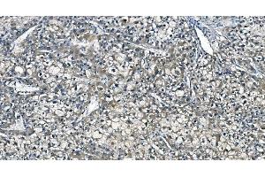 IHC analysis of ASS1 using anti-ASS1 antibody (ABIN7601192).