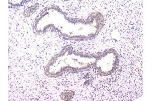 IHC analysis of PPID using anti-PPID antibody (ABIN6719438). (PPID anticorps  (AA 306-370))