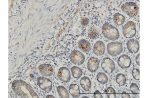 Immunoperoxidase of monoclonal antibody to IL1F7 on formalin-fixed paraffin-embedded human small Intestine.