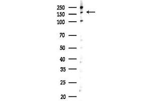 anti-Insulin Receptor Substrate 1 (IRS1) (pSer307) antibody