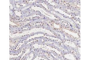 ABIN6266662 at 1/100 staining human kidney tissue sections by IHC-P.