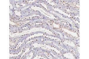ABIN6266662 at 1/100 staining human kidney tissue sections by IHC-P. (TIMP4 anticorps  (C-Term))