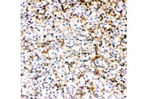 IHC analysis of MCP1/CCL2 using anti-MCP1/CCL2 antibody (ABIN3042598). (CCL2 anticorps  (AA 24-99))