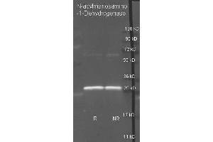 Goat anti N-acylmanosamino-1-Dehydrogenase antibody ( was used to detect purified N-acylmanosamino-1-Dehydrogenase under reducing (R) and non-reducing (NR) conditions. (WECC anticorps  (Biotin))