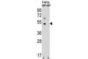 Western Blotting (WB) image for anti-DnaJ (Hsp40) Homolog, Subfamily B, Member 6 (DNAJB6) antibody (ABIN2996781)