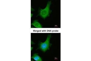 ICC/IF Image Immunofluorescence analysis of paraformaldehyde-fixed HeLa, using Calcium Sensing Receptor, antibody at 1:200 dilution. (CASR anticorps)