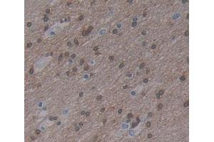 Used in DAB staining on fromalin fixed paraffin- embedded brain tissue (MYT1 anticorps  (AA 903-1121))