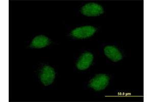 Immunofluorescence of purified MaxPab antibody to SNAI1 on HeLa cell. (SNAIL anticorps  (AA 1-264))