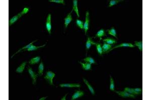 Immunofluorescence staining of Hela cells with ABIN7173813 at 1:330, counter-stained with DAPI.