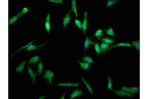 Immunofluorescence staining of Hela cells with ABIN7173813 at 1:330, counter-stained with DAPI. (FASL anticorps  (AA 103-281))