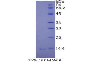 SDS-PAGE (SDS) image for Chemokine (C-X-C Motif) Ligand 11 (CXCL11) (AA 22-94) protein (His tag) (ABIN1080041) (CXCL11 Protein (AA 22-94) (His tag))
