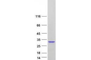 Validation with Western Blot