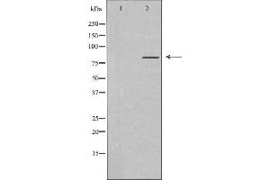 Western blot analysis of extracts from K562 cells, using MLH1 antibody. (MLH1 anticorps  (Internal Region))