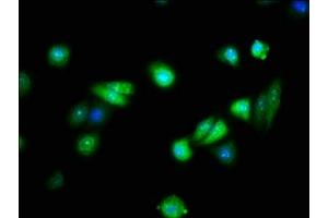 Immunofluorescence staining of HepG2 cells with ABIN7152575 at 1:133, counter-stained with DAPI. (FAIM anticorps  (AA 1-179))