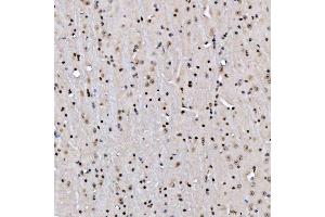 IHC analysis of STAG2 using anti-STAG2 antibody (ABIN7602420).