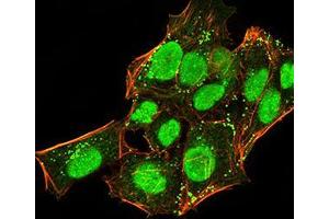 Immunofluorescence analysis of Hela cells using CBX5 mouse mAb (green).
