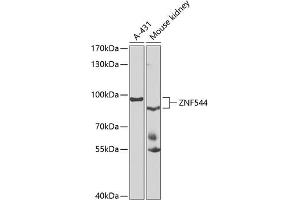 Western blot analysis of extracts of various cell lines, using ZNF544 antibody (ABIN6133073, ABIN6150511, ABIN6150513 and ABIN6223223) at 1:1000 dilution. (ZNF544 anticorps  (AA 1-230))