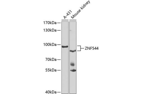 ZNF544 anticorps  (AA 1-230)