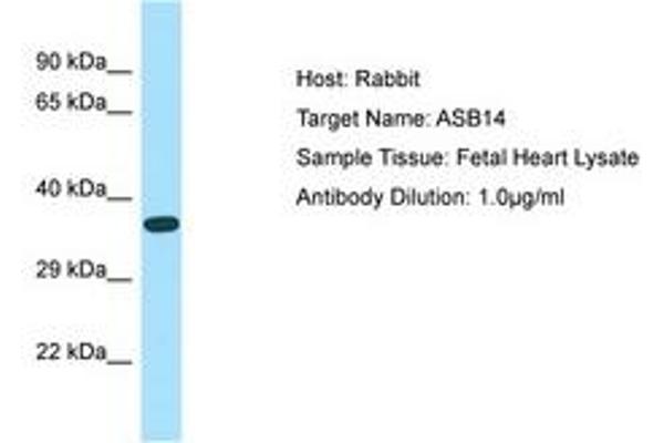 ASB14 anticorps  (AA 45-94)