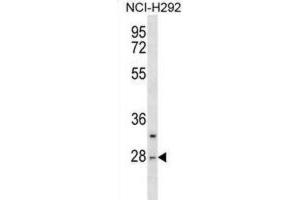 Western Blotting (WB) image for anti-Chymotrypsin (CTRL) antibody (ABIN3000405) (Chymotrypsin anticorps)