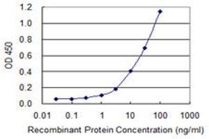 Detection limit for recombinant GST tagged SERPINB1 is 0.