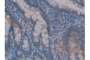 Detection of MMP3 in Rat Intestine Tissue using Polyclonal Antibody to Matrix Metalloproteinase 3 (MMP3)