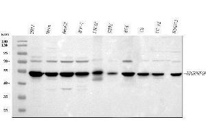 Western blot analysis of HnRNP H/HNRNPH1 using anti-HnRNP H/HNRNPH1 antibody (ABIN4886623). (HNRNPH1 anticorps  (N-Term))