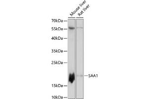 Western blot analysis of extracts of various cell lines, using S antibody (ABIN7270255) at 1:3000 dilution. (SAA1 anticorps  (AA 1-100))