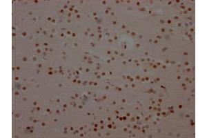 IHC image of ABIN7127371 diluted at 1:100 and staining in paraffin-embedded human brain tissue performed on a Leica BondTM system. (Recombinant BRD4 anticorps)