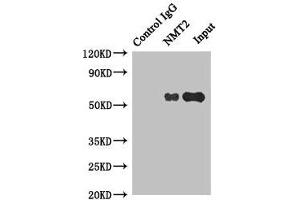 Immunoprecipitating NMT2 in HepG2 whole cell lysate Lane 1: Rabbit control IgG instead of (1 μg) instead of ABIN7154259 in HepG2 whole cell lysate.