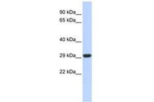 Image no. 1 for anti-Succinate Dehydrogenase Complex, Subunit B, Iron Sulfur (Ip) (SDHB) (C-Term) antibody (ABIN6741010)