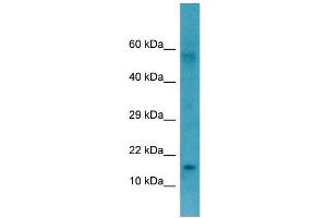 WB Suggested Anti-CTAG1B Antibody Titration: 1.
