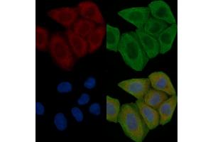 Paxillin Antibody staining Hela cells(30 min of UV treatment) by IF/ICC.