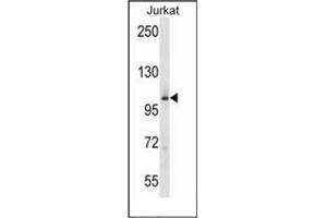 Western blot analysis of MAP4K2 Antibody (Center) in Jurkat cell line lysates (35ug/lane).