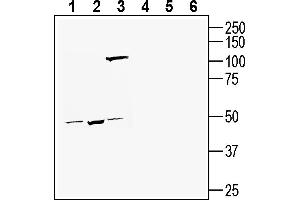 Western blot analysis of human SH-SY5Y neuroblastoma cell line lysate (lanes 1 and 4), human  monocytic leukemia cell line lysate (lanes 2 and 5) and human LNCaP prostate adenocarcinoma cell line lysate (lanes 3 and 6):1-3. (TMEM175 anticorps  (AA 278-291))