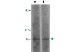 Western blot analysis of FRMPD2 in rat kidney tissue lysate with FRMPD2 polyclonal antibody  at (A) 1 and (B) 2 ug/mL . (FRMPD2 anticorps  (N-Term))