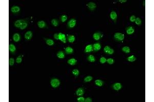 Immunofluorescence staining of Hela cells (treated with 30mM sodium butyrate for 4h) with ABIN7139194 at 1:7.