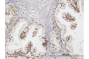Immunoperoxidase of purified MaxPab antibody to RAD23B on formalin-fixed paraffin-embedded human prostate. (RAD23B anticorps  (AA 1-409))